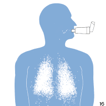 Inhal&aacute;tor s&nbsp;kom&ocirc;rkou